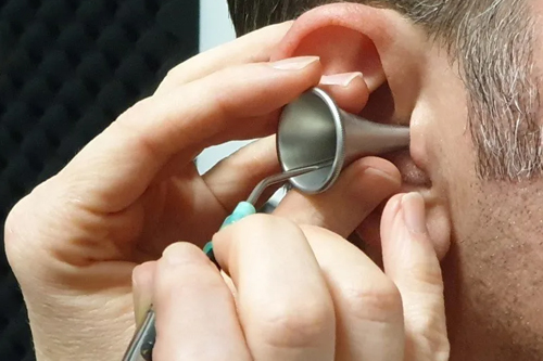 Earwax Removal
