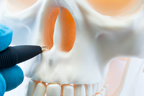 Deviated Septum Correction (Septoplasty)
