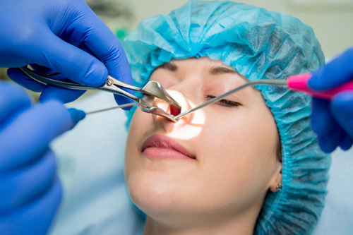 Functional Endoscopic Sinus Surgery (FESS)