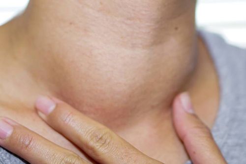 Diagnosis and Surgical Treatment of Thyroid Disorders
