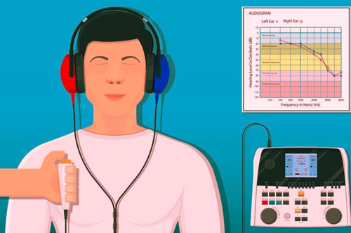Pure Tone Audiometry (PTA)