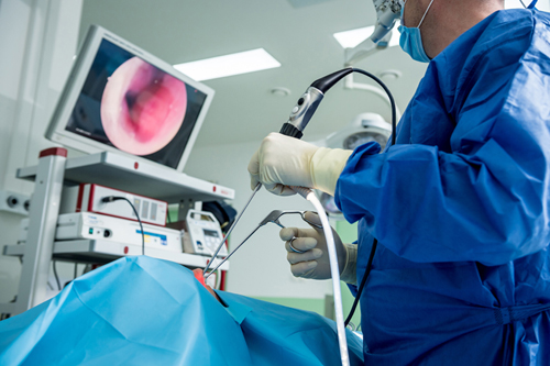 Diagnostic Nasal Endoscopy