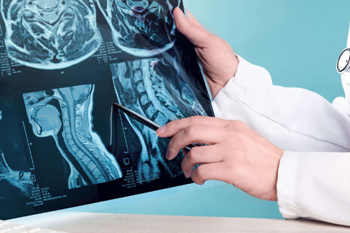 Head & Neck Diagnosis